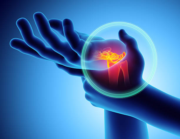 Carpal Tunnel Syndrome Treatment - Spine and Wellness Cincinnati